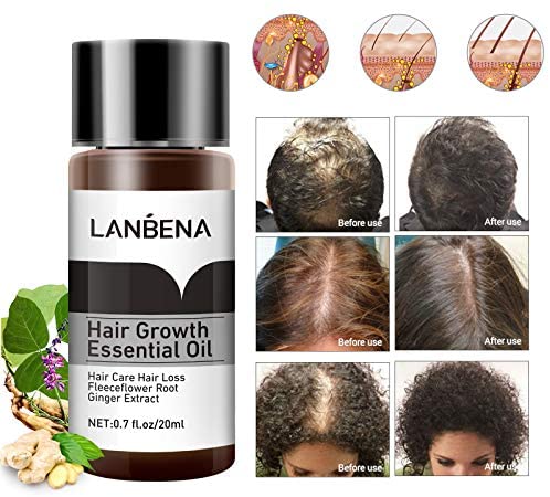 سرم رشد مو لانبنا اصلی تضمینی