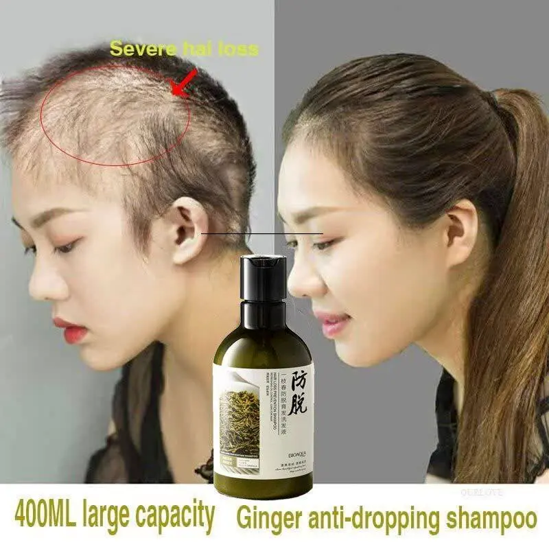 شامپو ضد ریزش رزماری