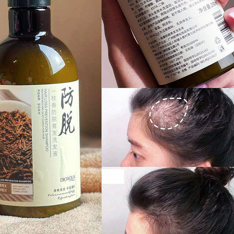 شامپو ضد ریزش رزماری