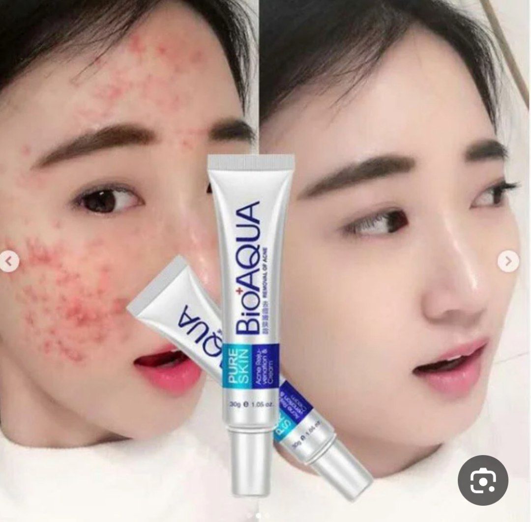 کرم ضد جوش بیو آکورا